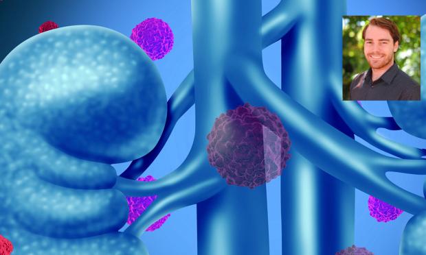 Kidney and Rob Ellis